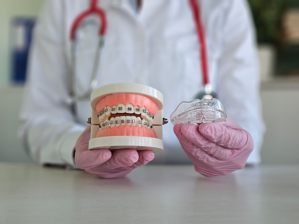 Braces vs. Invisalign: Which Is Better for Your Facial Aesthetics?
