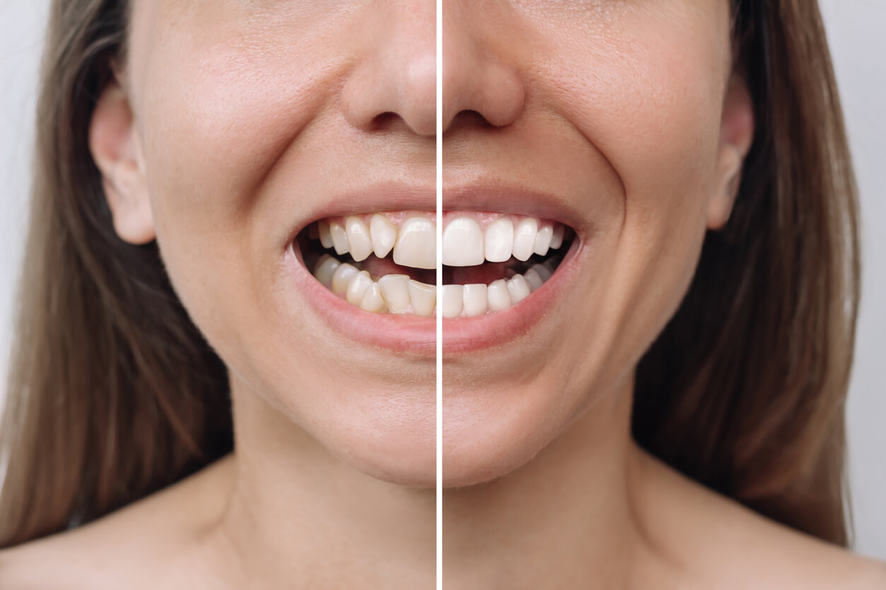 Is Oral Surgery Covered as Medical or Dental Procedure?